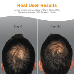 Viviscal Men's Hair Growth Supplements for Thicker Fuller Hair, 3 Month Supply