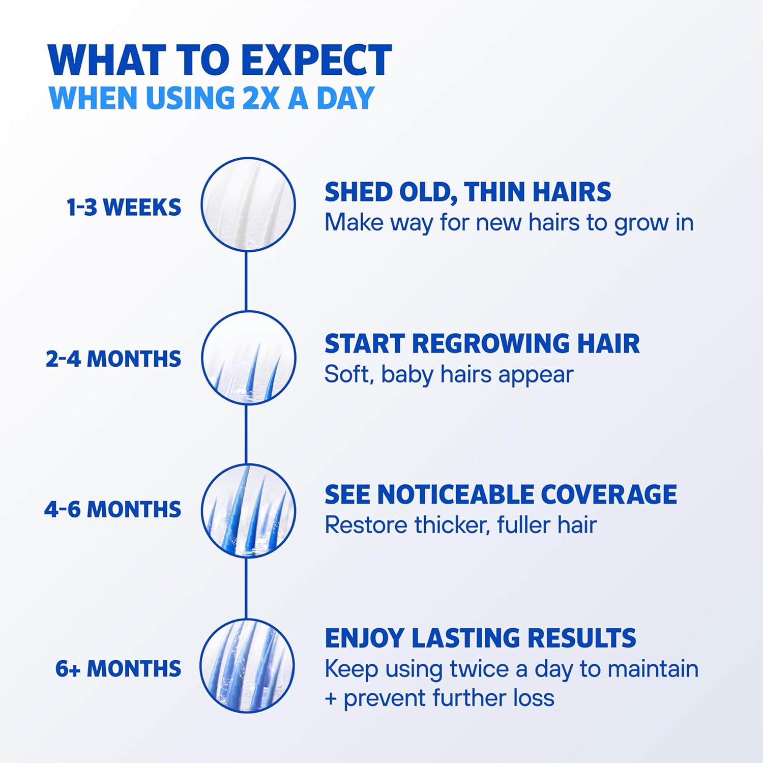 Men’s Rogaine Extra Strength 5% Minoxidil Topical Solution for Hair Loss, 3 Month Supply