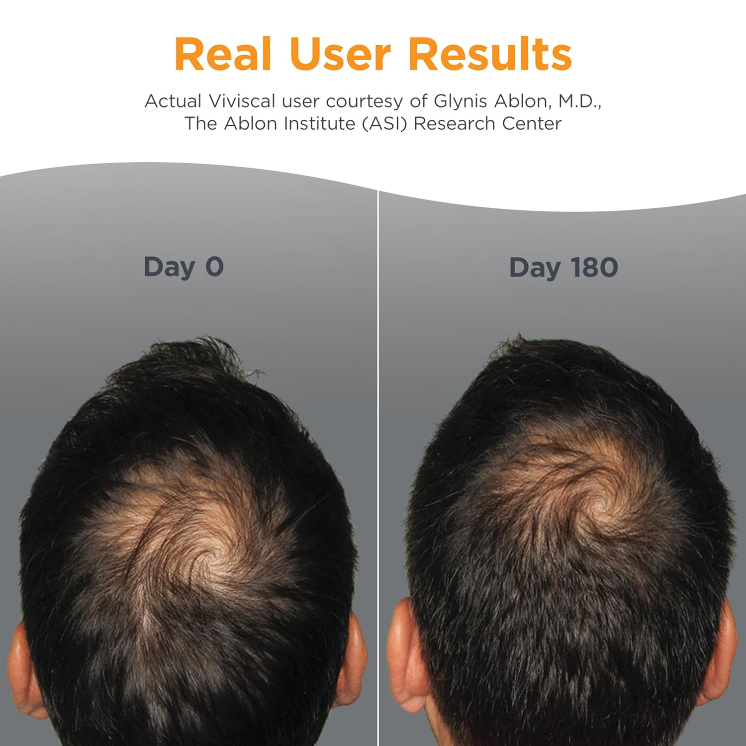 Viviscal Men's Hair Growth Supplements for Thicker Fuller Hair, 3 Month Supply